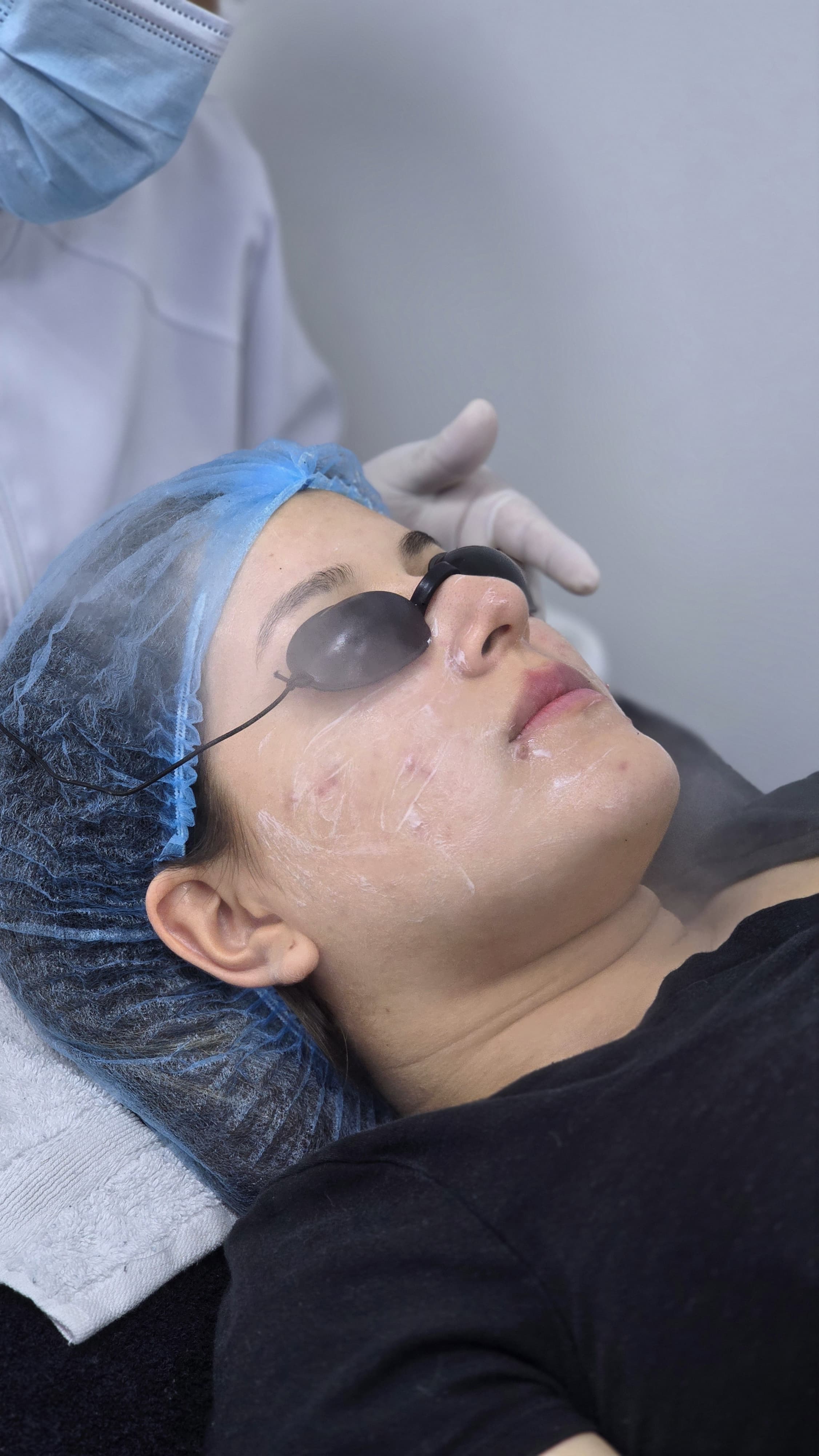 Limpieza Facial Profunda