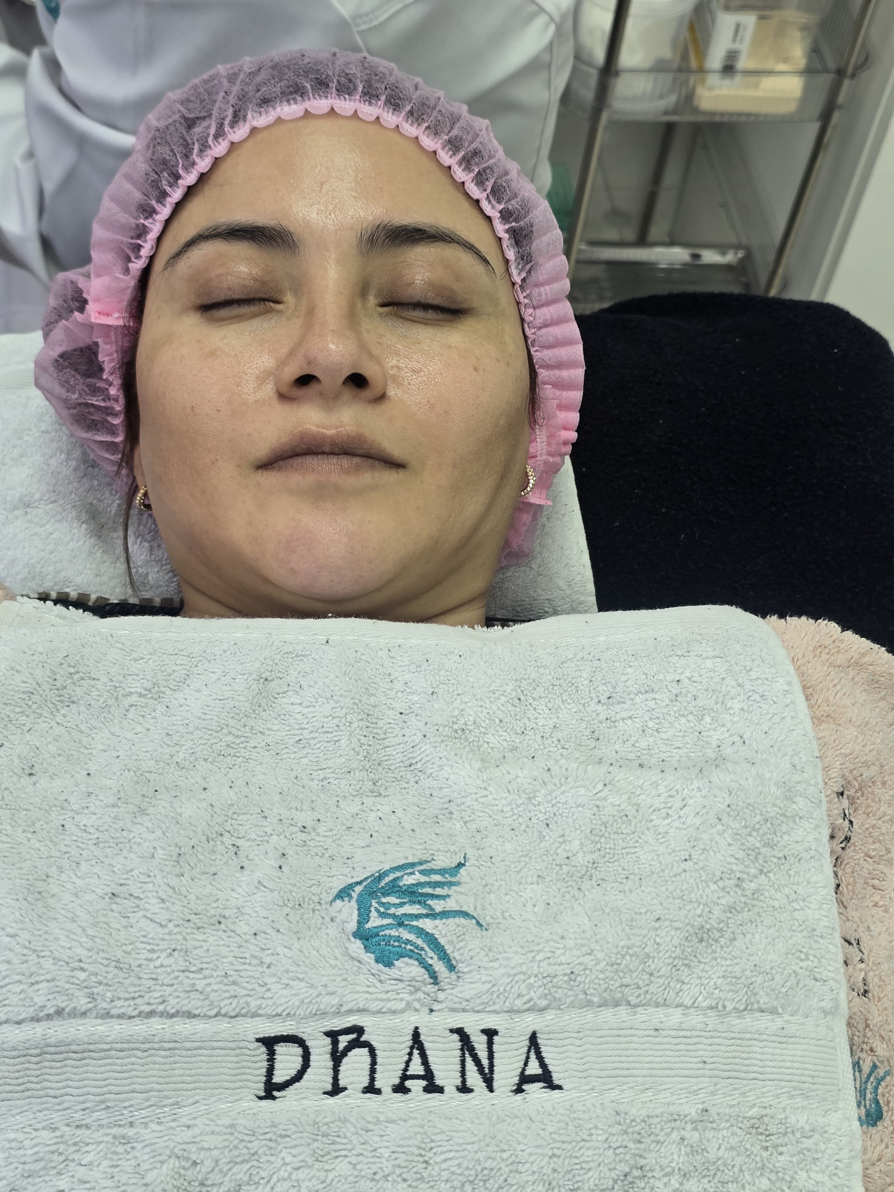Tratamiento de medicina estética en Prana